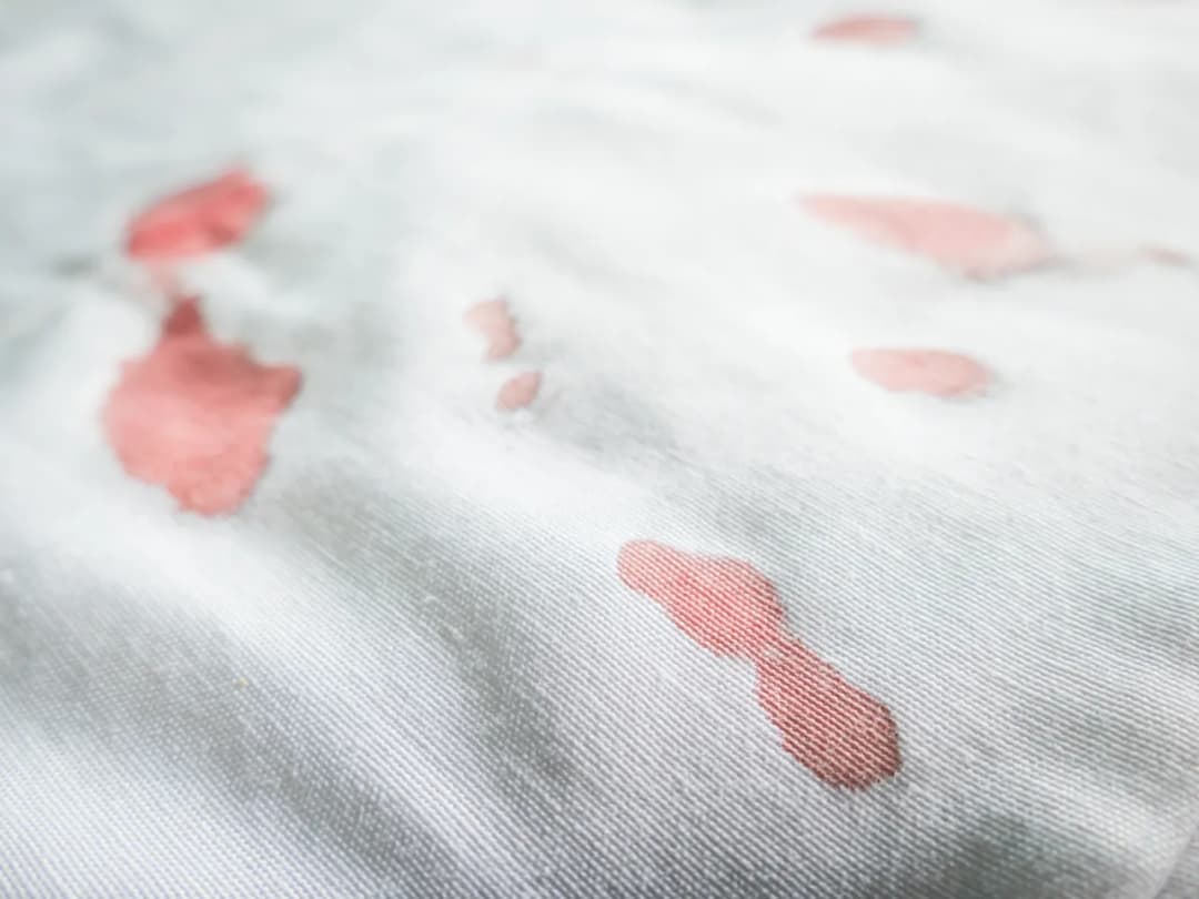 Czy Vanish usuwa plamy z krwi? Sprawdź jego skuteczność na tkaninach